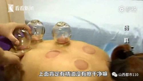 拔罐视频在线观看,跟随视频学习拔罐技巧与体验